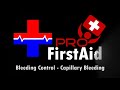 Bleeding Control: Capillary Bleeding