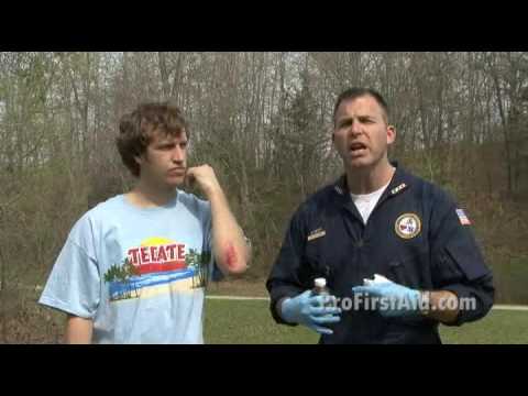 how to treat oozing wounds