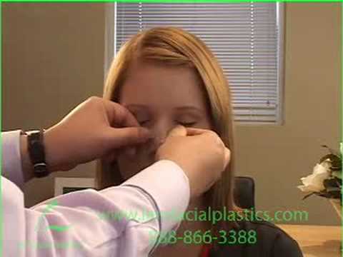 how to properly massage nose after rhinoplasty