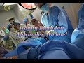 My Surrogacy Story