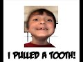 Thumbnail #2