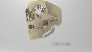 Joel Joshi Otero-35