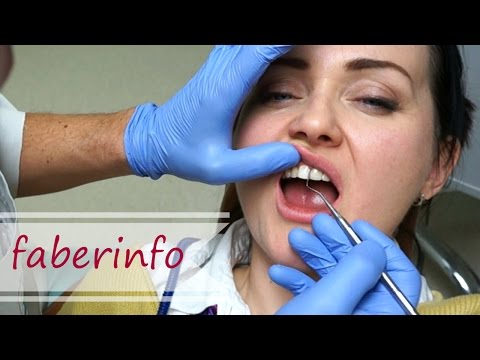 Отбеливание зубов если есть виниры Отбеливание зубов если есть виниры