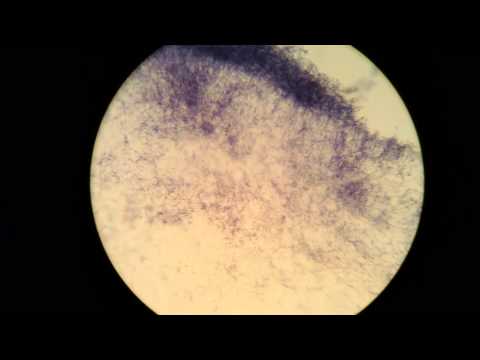 how to isolate actinomycetes from soil