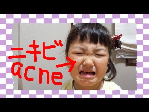 ほっぺにニキビが出来て泣くもも Birthday cake make an acne on Momo's cheak