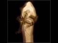 MORTUUS - Rebirth in the Sterile Triad of Six -