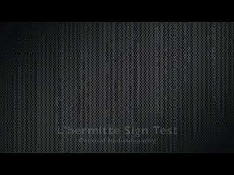 how to perform lhermitte's test