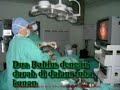 pembedahan laparoscopy - cyst with non communicating horn