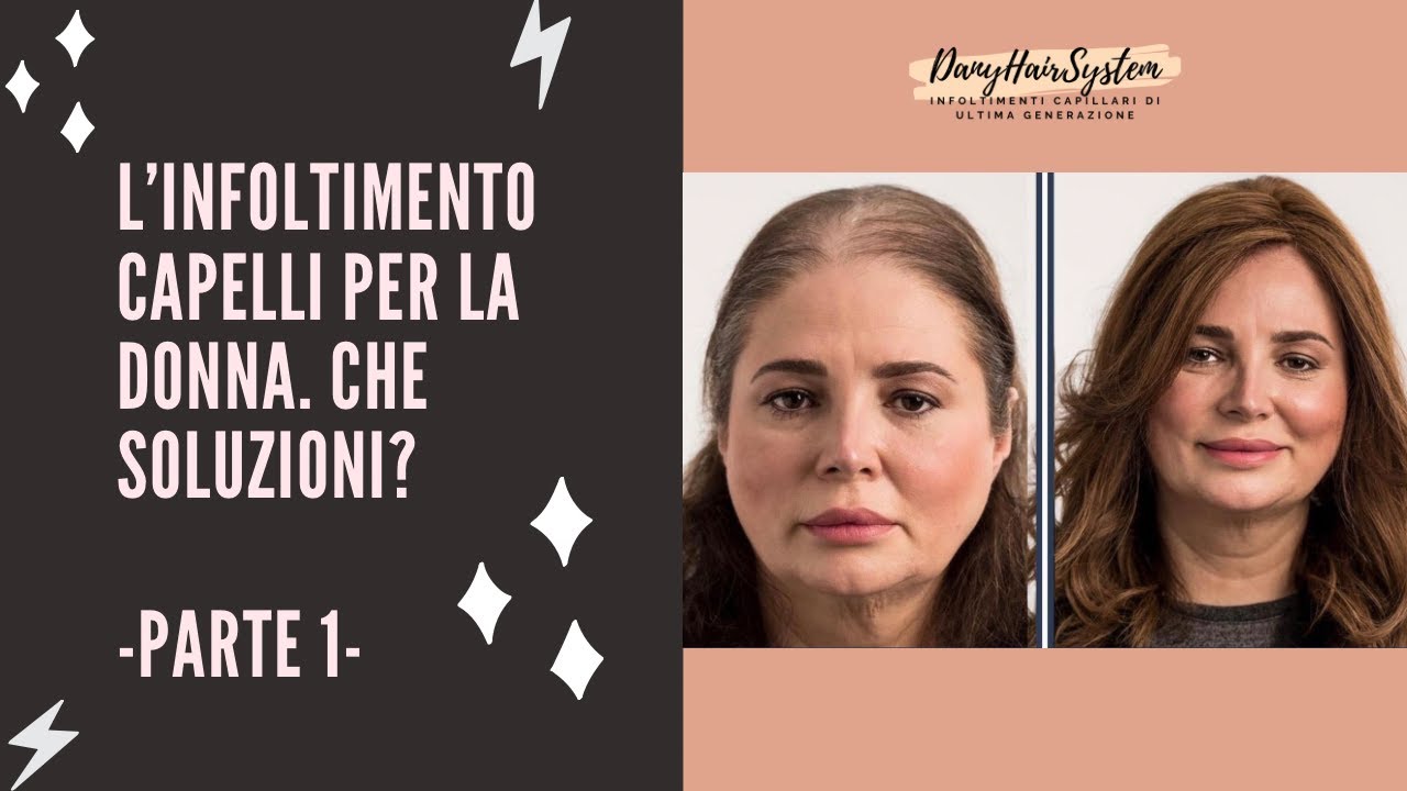 L'infoltimento capelli per la calvizie o diradamento nella DONNA, che soluzioni?