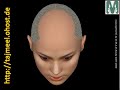 Hair Restoration (ARABIC)  د. محمد الروبى  زراعة الشعر