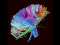 Panic Station (2012) (Song) by Muse