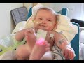 Click here to watch this video Grayson's Story