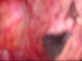 videos de Dead cow eye poking