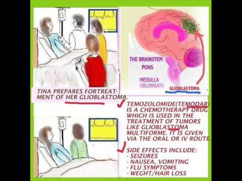 how to be a transplant nurse