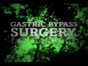 UHS Bariatrics TV Commercial