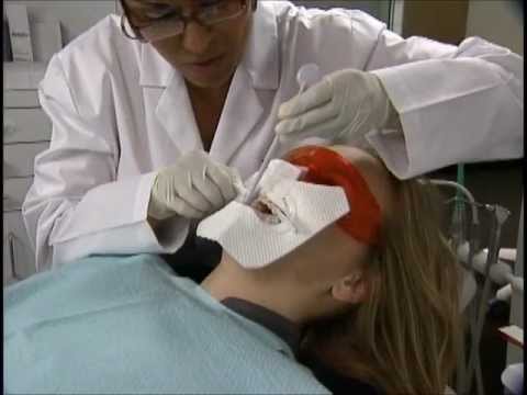 how to whiten teeth zoom