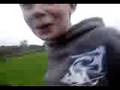 videos de Narcolepsy#5 Patricks Adventures Season1 Episode 9