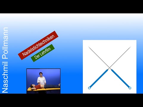 Nadelstichtechniken Akupunktur