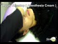 Skinzon CTS Roller Treatment