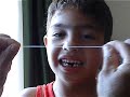 Extraccion dental