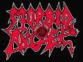 Pete Sandoval (Morbid Angel) Drum Check