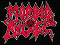 Pete Sandoval (Morbid Angel) Drum Check