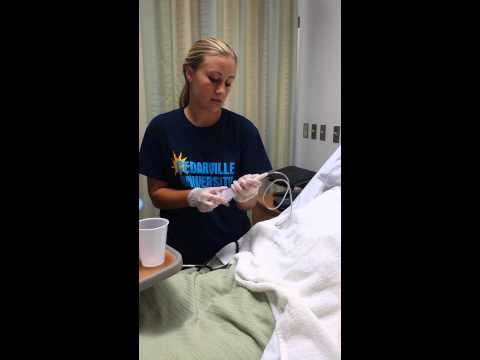 how to remove ng feeding tube