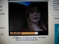 Pit  bull locks onto 7 year old girl's face, Part II