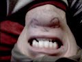 my chin