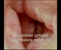 Bu videoyu izleyip te sigara i�meye devam edene \"pes\" diyoru