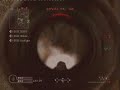 BF vs DGSE Manche 2 Part 2