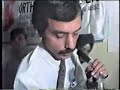 Workshop Video - Correction of Distal Femoral Deformity Part 1