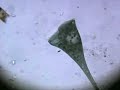 Stentor Feeding on Euglena