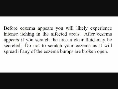 how to relieve heartburn nhs