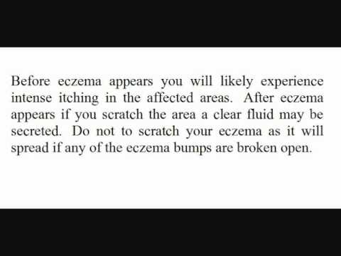 how to relieve heartburn nhs