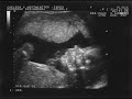 IM PREGNANT 2! IM PREGNANT 2!
