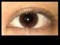 Single 2 Double - Asian Eyelid Surgery