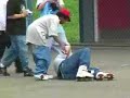 comment se casse le nez