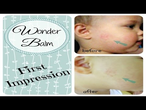 how to control eczema