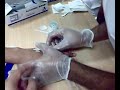 I.V. Cannulation - Husain I.V. Cannulation - Husain