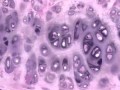 hyaline cartilage.mp4