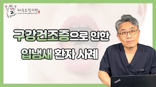 구강건조증으로 인한 입냄새