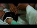 VidDoc - 02 - IIFAS-2008-El Salvador - Podiatry Resource Network