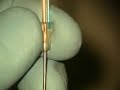 Perioscopy Sheath/Fiber Complex and Explorer Detail
