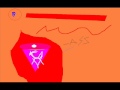 When Spongebob dies remake.wmv