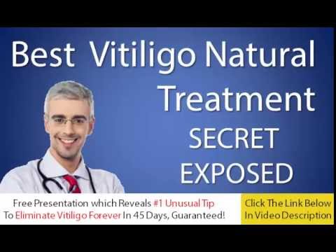 how to white spots on skin