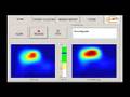 Medical - Breast Cancer Detection