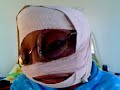 # 11 Miss Tulahead A Short While After Her Surgery !! # 11 Miss Tulahead A Short While After Her Surgery !!