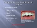 Oral Care for Parents and Caregivers of CSHCN