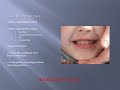 Oral Care for Parents and Caregivers of CSHCN